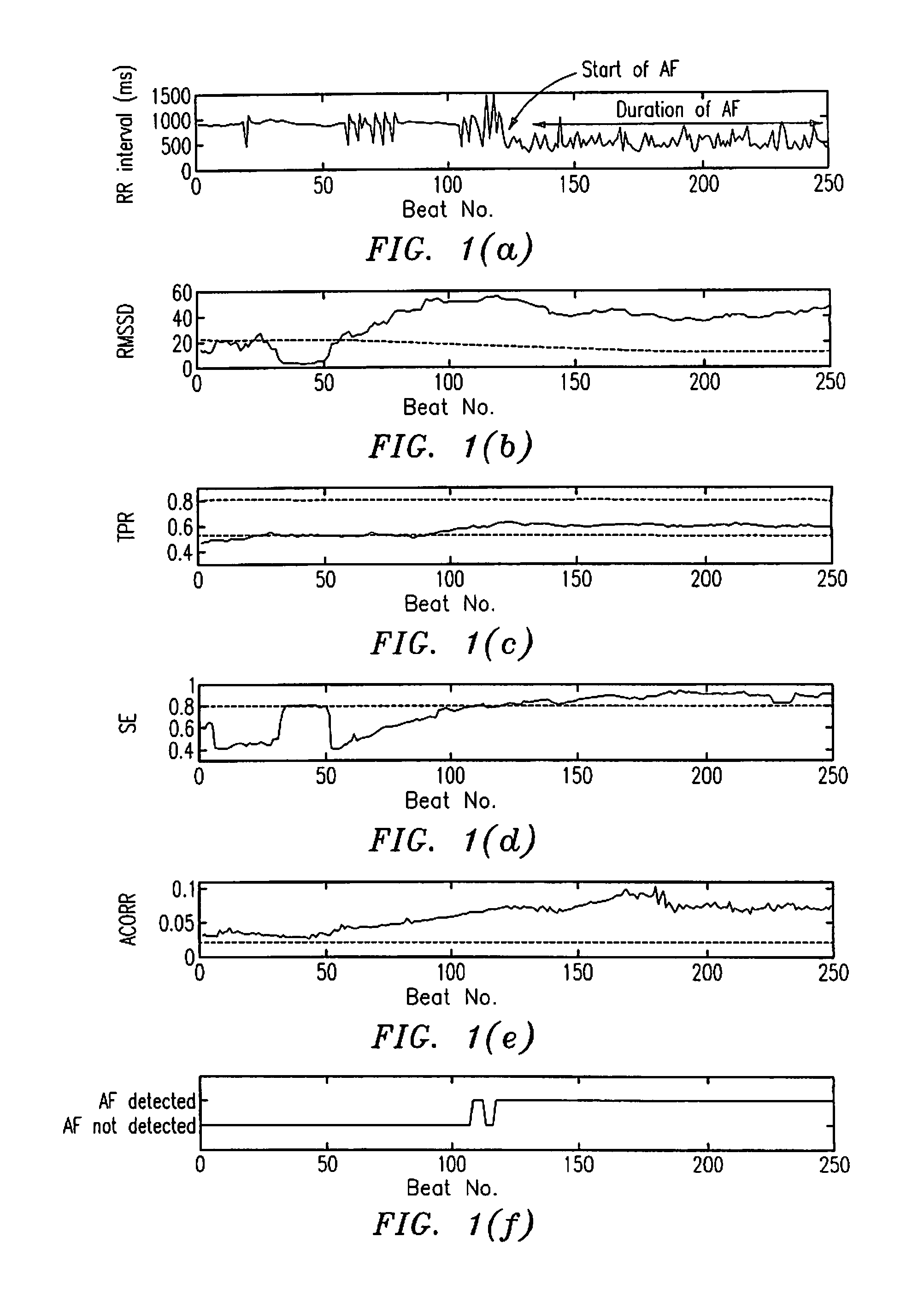 RR interval monitoring method and blood pressure cuff utilizing same