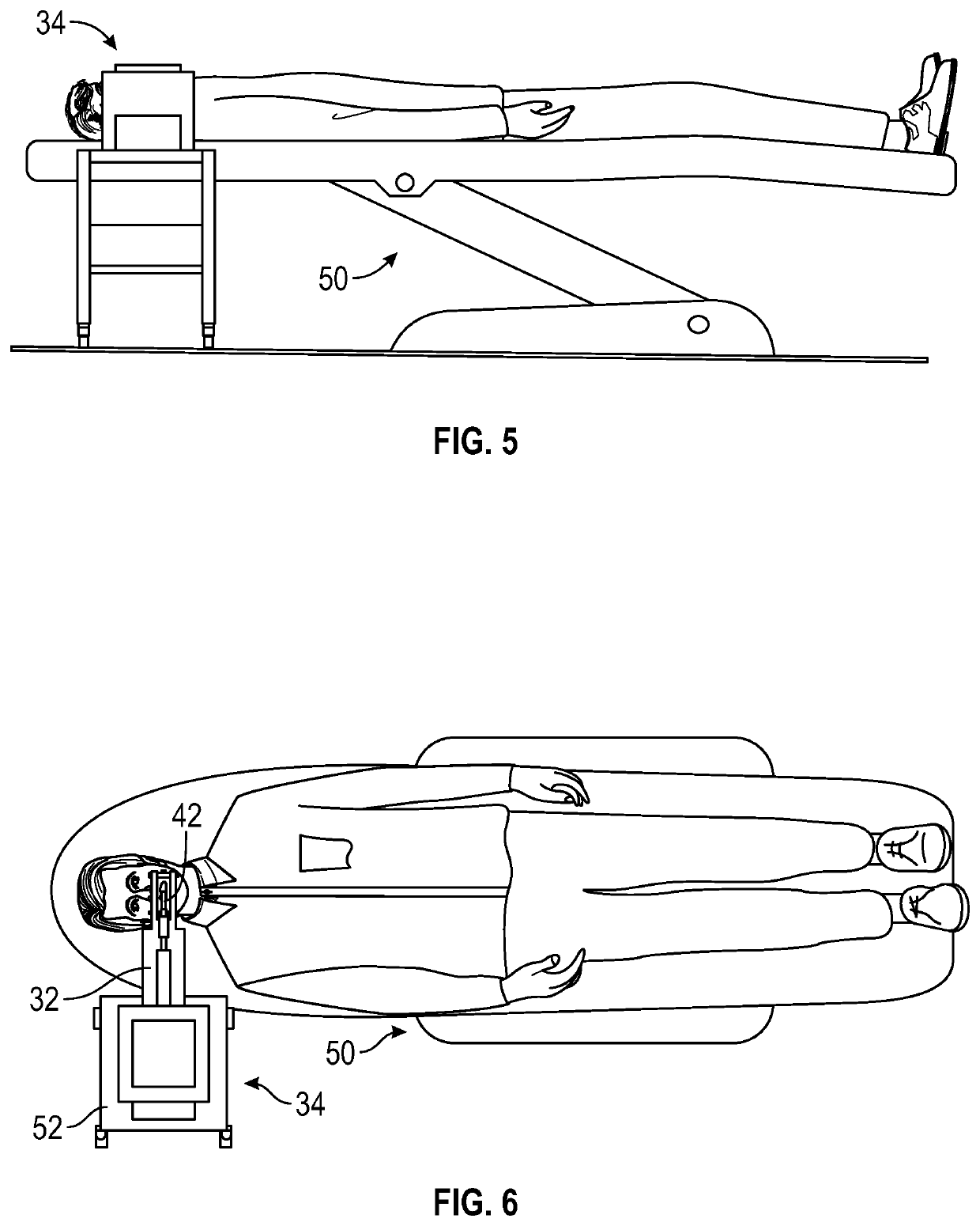 Apparatus for in situ restoration of unconstrained dental structure