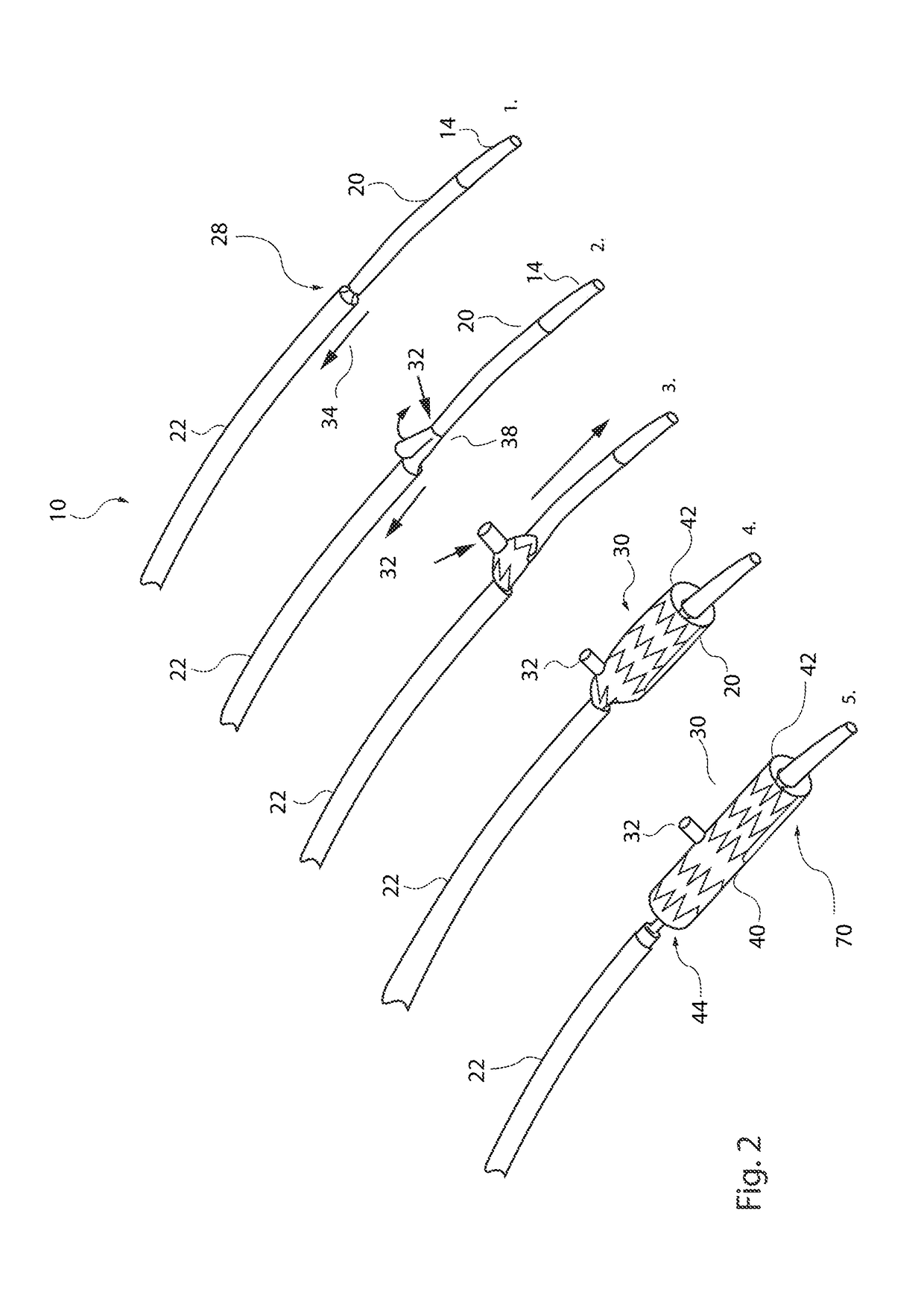 Medical device introducer assembly particularly for branched medical devices