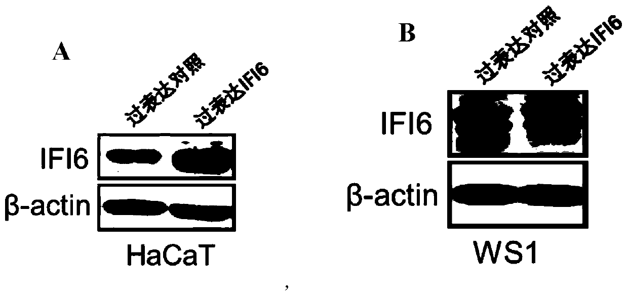 Application of interferon-induced protein 6 and medicine