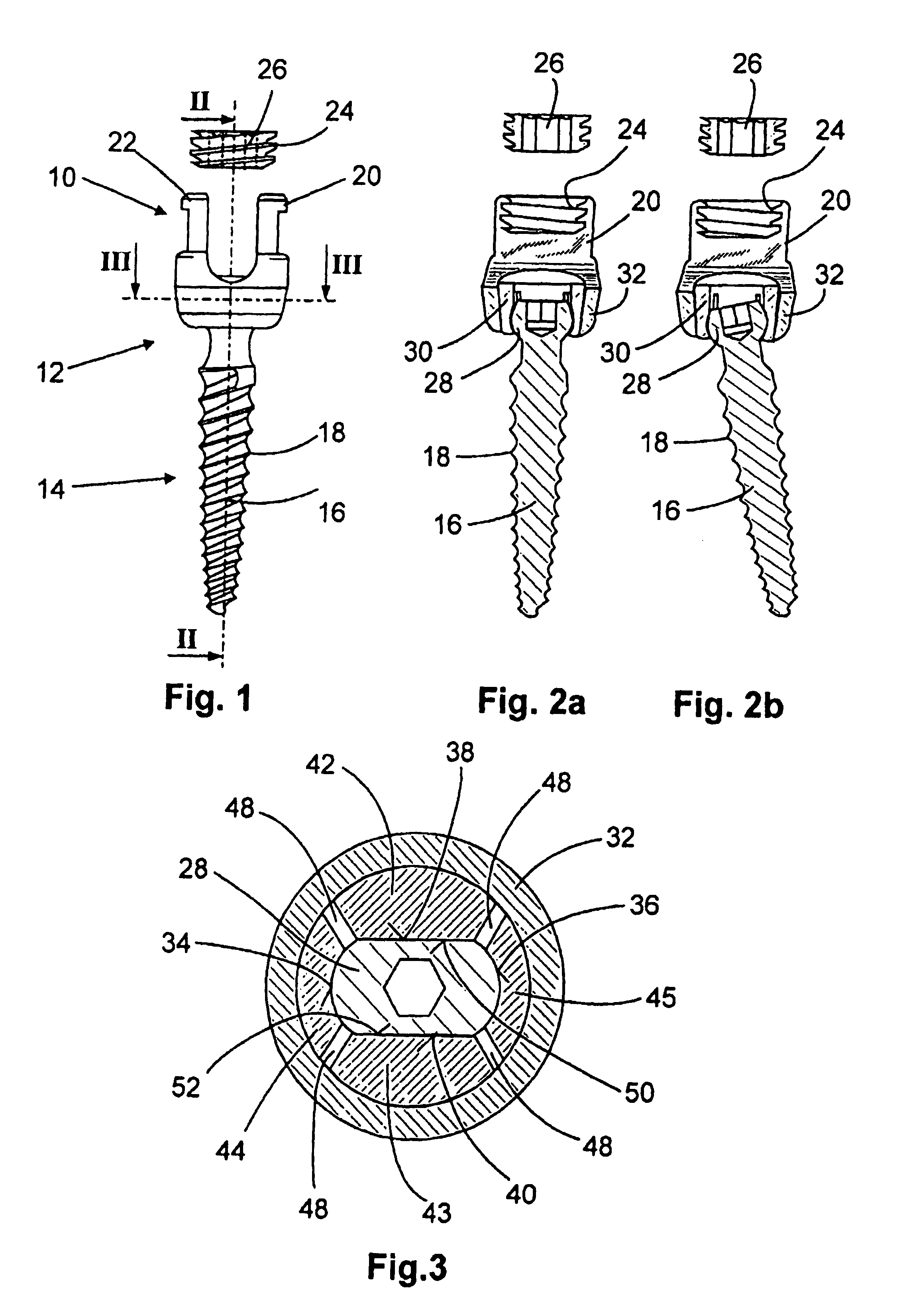 Anchoring element for fastening a rod of a device for adjusting a human or animal vertebral column on a vertebra