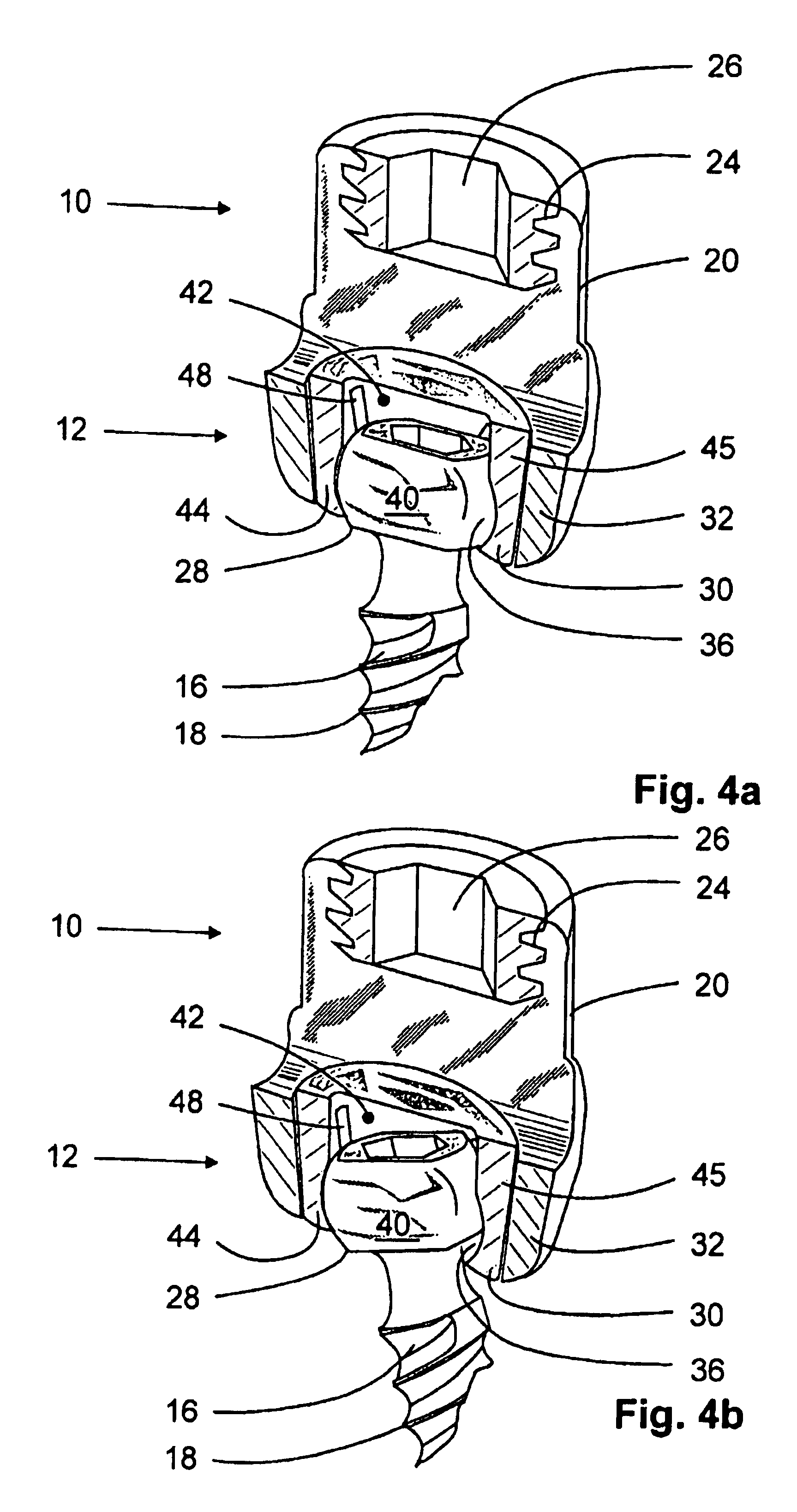 Anchoring element for fastening a rod of a device for adjusting a human or animal vertebral column on a vertebra