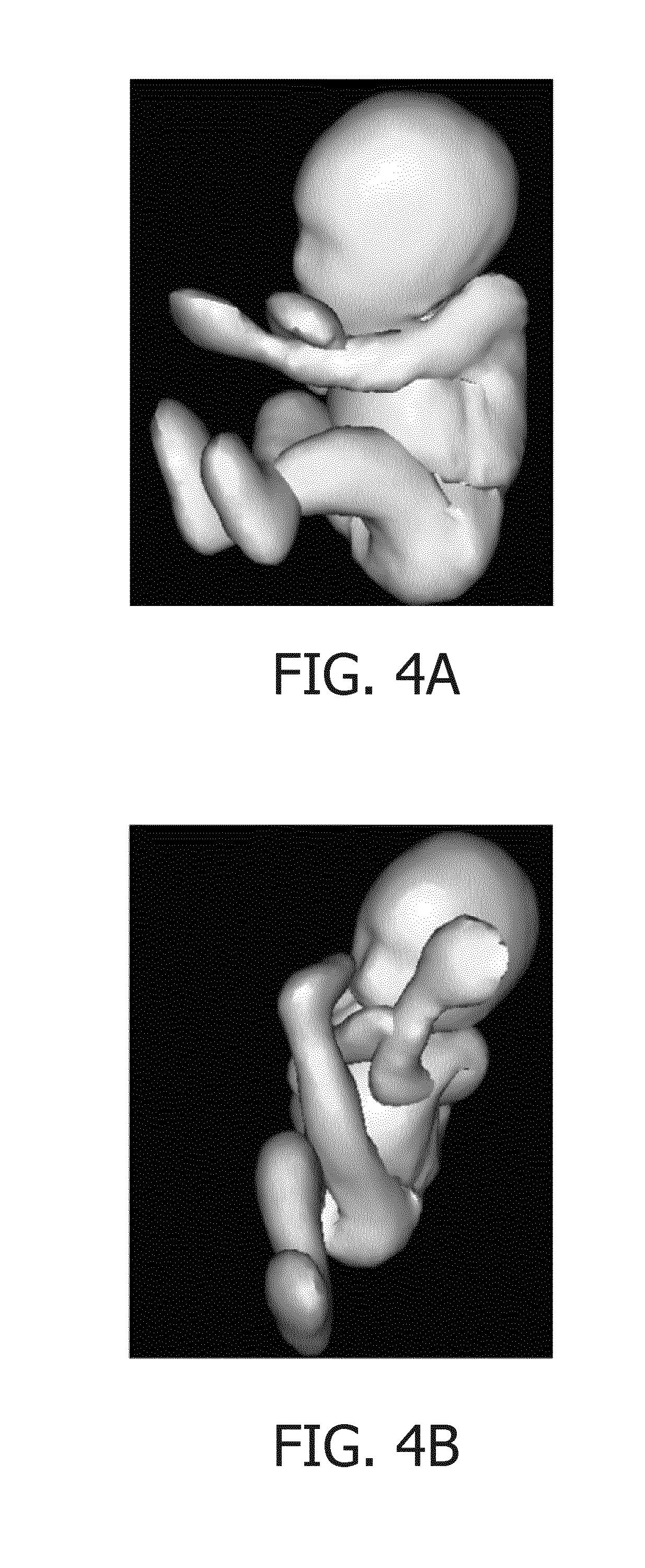 3D image compounding for ultrasound fetal imaging