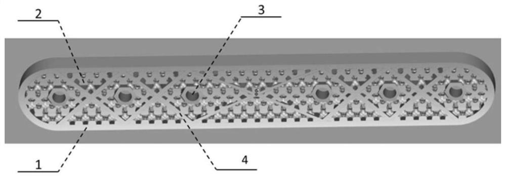 A 3D printed porous tantalum metal bone plate