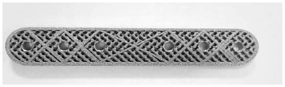 A 3D printed porous tantalum metal bone plate