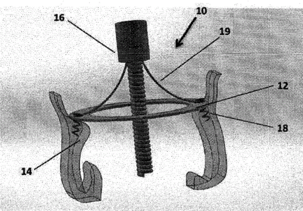 Single ring heart valve support structure