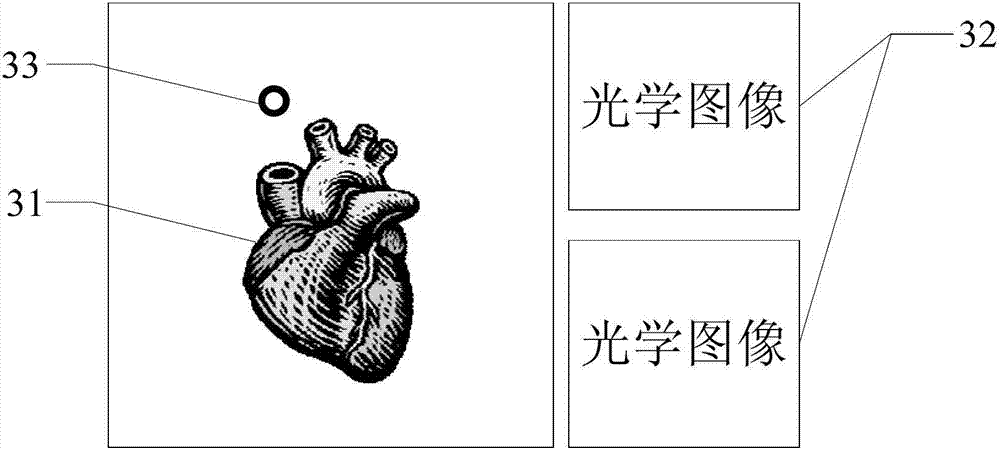 Simulation of Catheter Ablation of Atrial Fibrillation Based on Optical Binocular Positioning