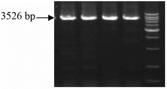 Method of applying adenovirus vector mediation ribose nucleic acid (RNA) jamming technology to silence sterol regulatory element binding protein 1