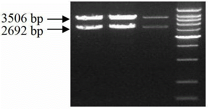 Method of applying adenovirus vector mediation ribose nucleic acid (RNA) jamming technology to silence sterol regulatory element binding protein 1