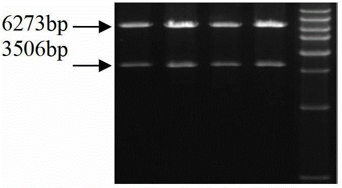 Method of applying adenovirus vector mediation ribose nucleic acid (RNA) jamming technology to silence sterol regulatory element binding protein 1