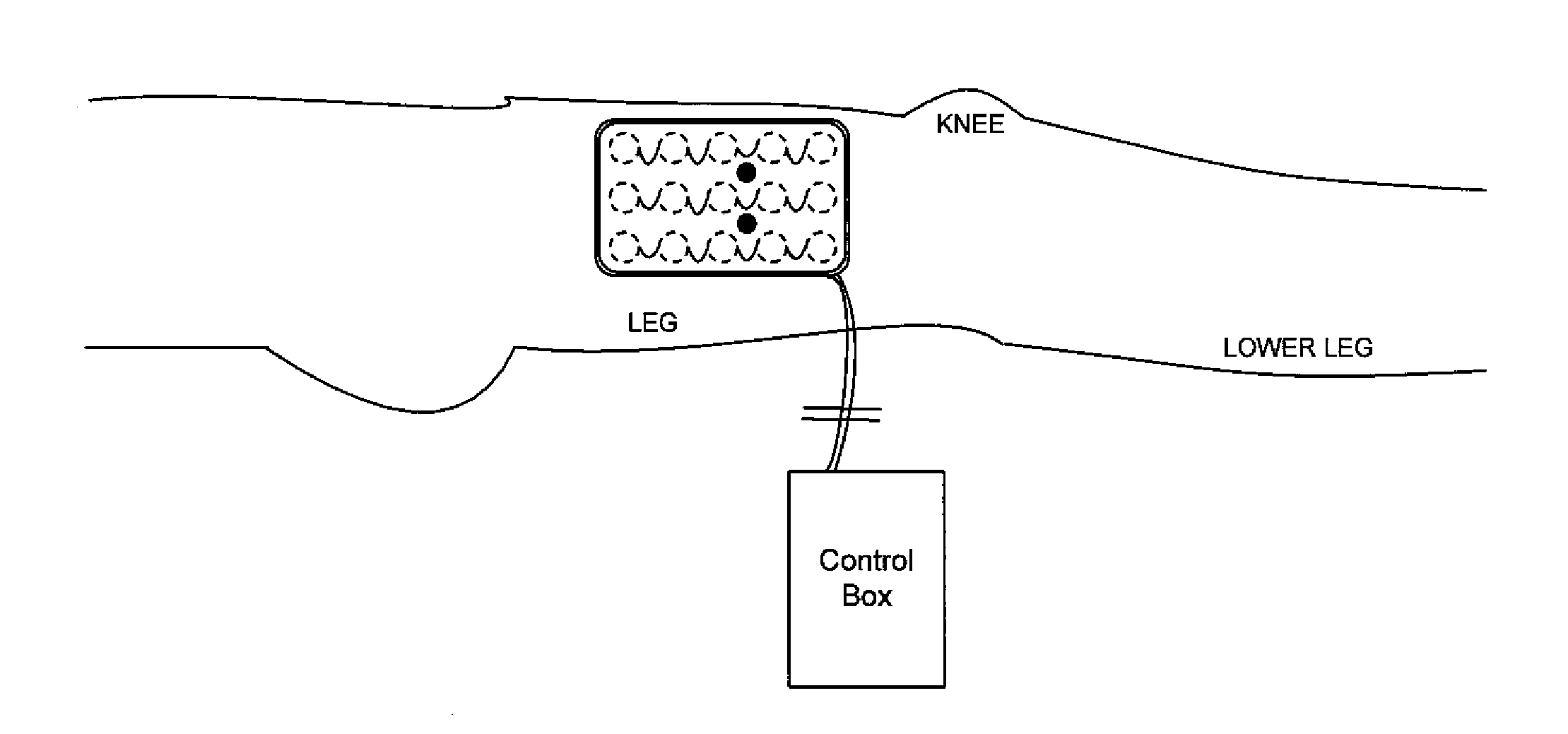 Systems and methods for automated muscle stimulation