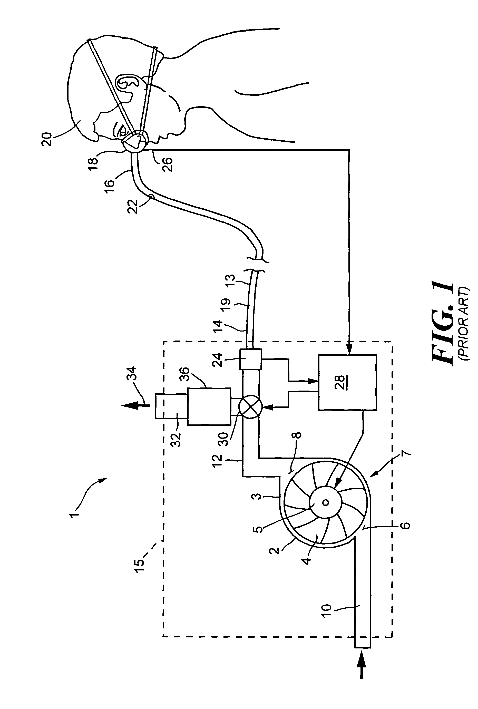 Pressure support system and method and a pressure control valve for use in such a system and method