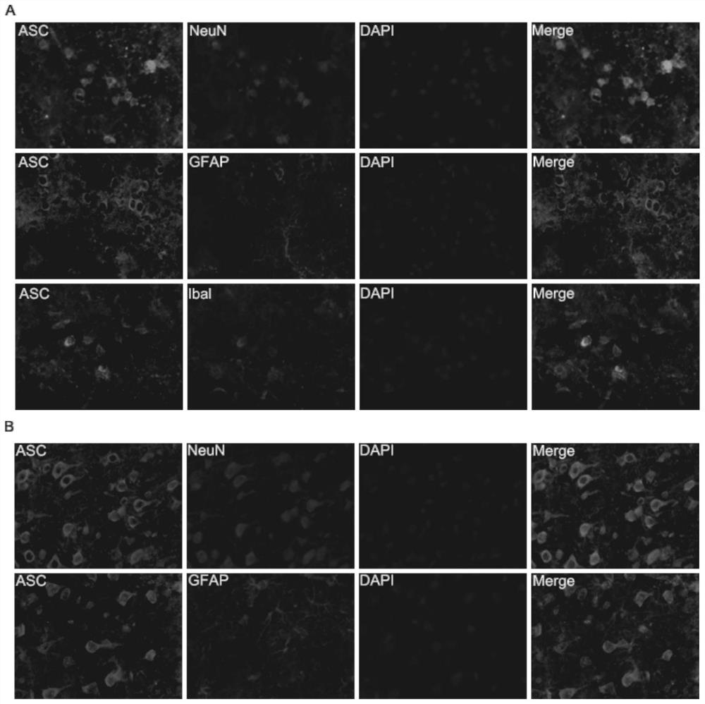 Application of exogenous recombinant protein reelin in the preparation of drugs for the treatment of cerebral hemorrhage