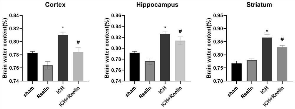 Application of exogenous recombinant protein reelin in the preparation of drugs for the treatment of cerebral hemorrhage