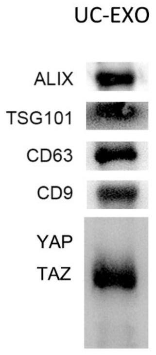 Application of marker based on TAZ level of single exosome transcription factor in serum in preparation of diagnosis for treating lung cancer