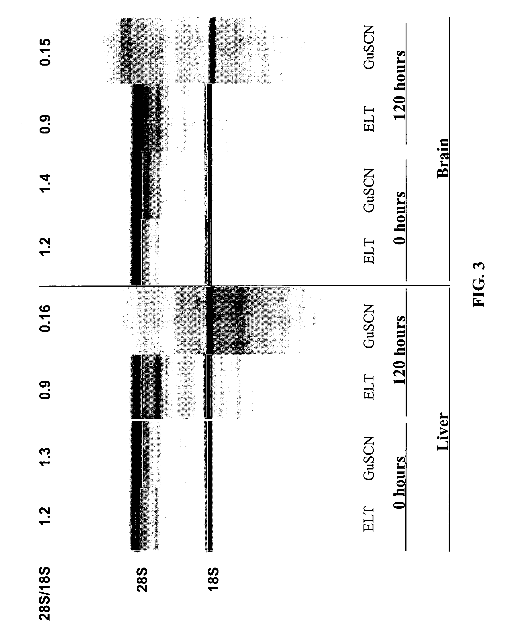 Enzymatic digestion of tissue