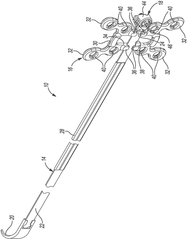 Sternal closure cerclage, plate implant and instrumentation