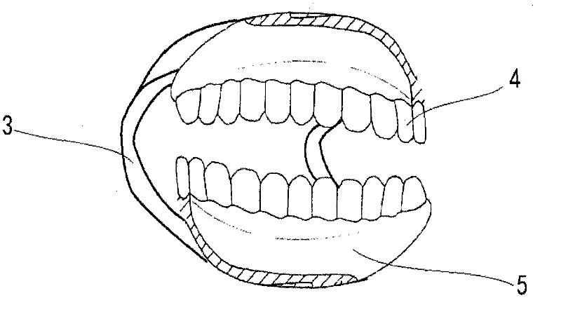LED (Light-Emitting Diode) artificial teeth