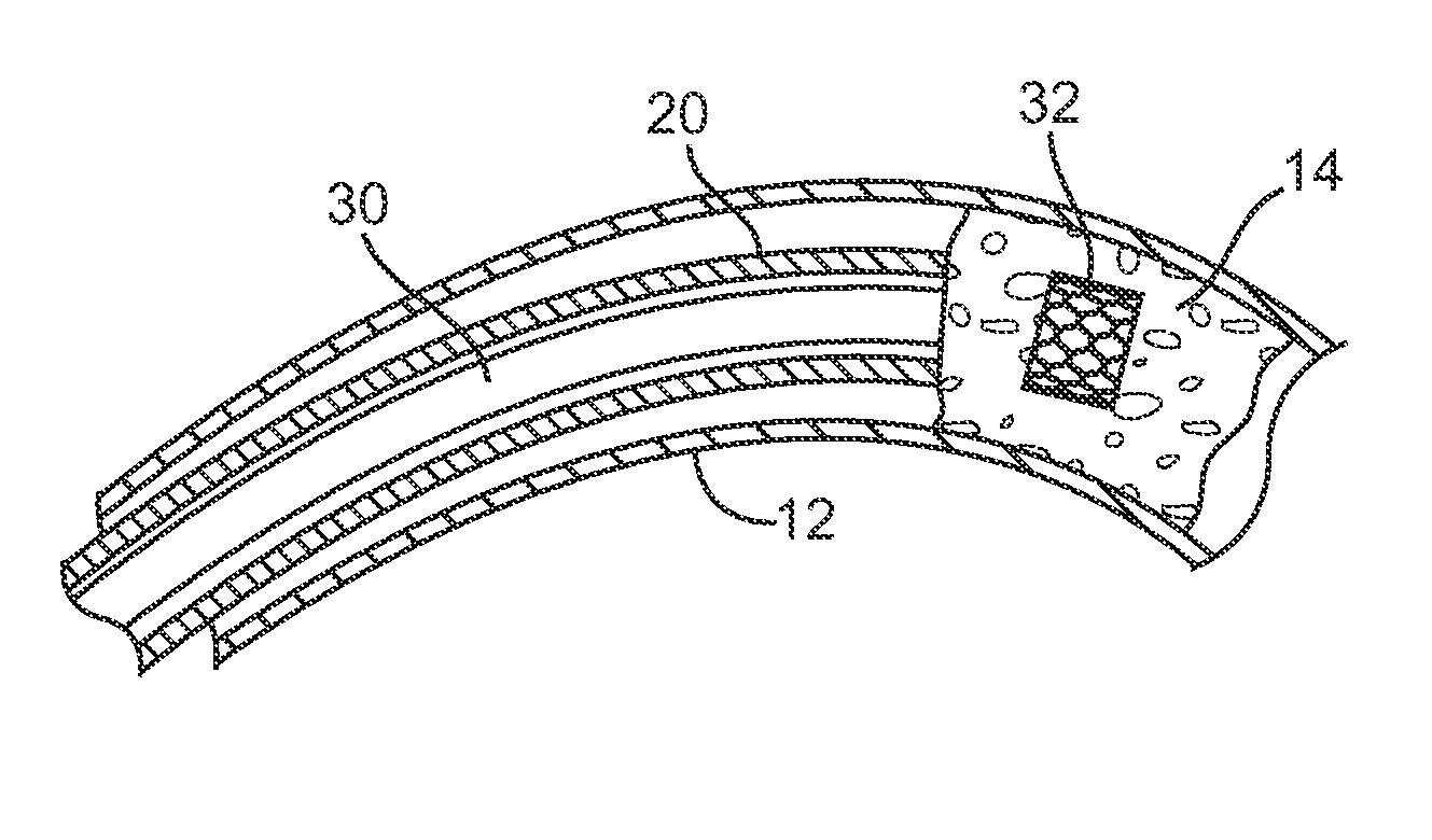 Drug-Eluting Device for Treatment of Chronic Total Occlusions