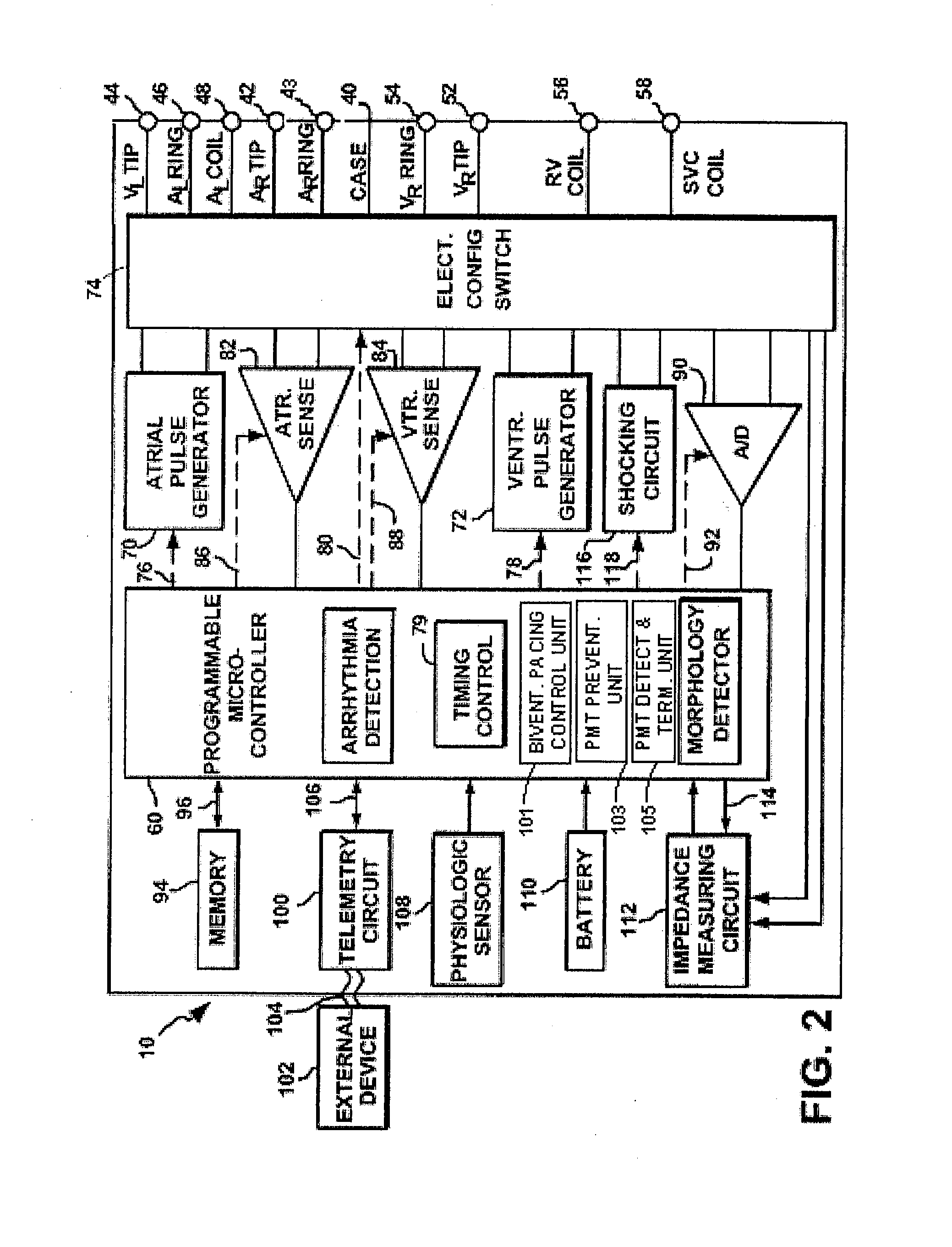 Systems and methods for preventing, detecting, and terminating pacemaker mediated tachycardia in biventricular implantable cardiac stimulation systems