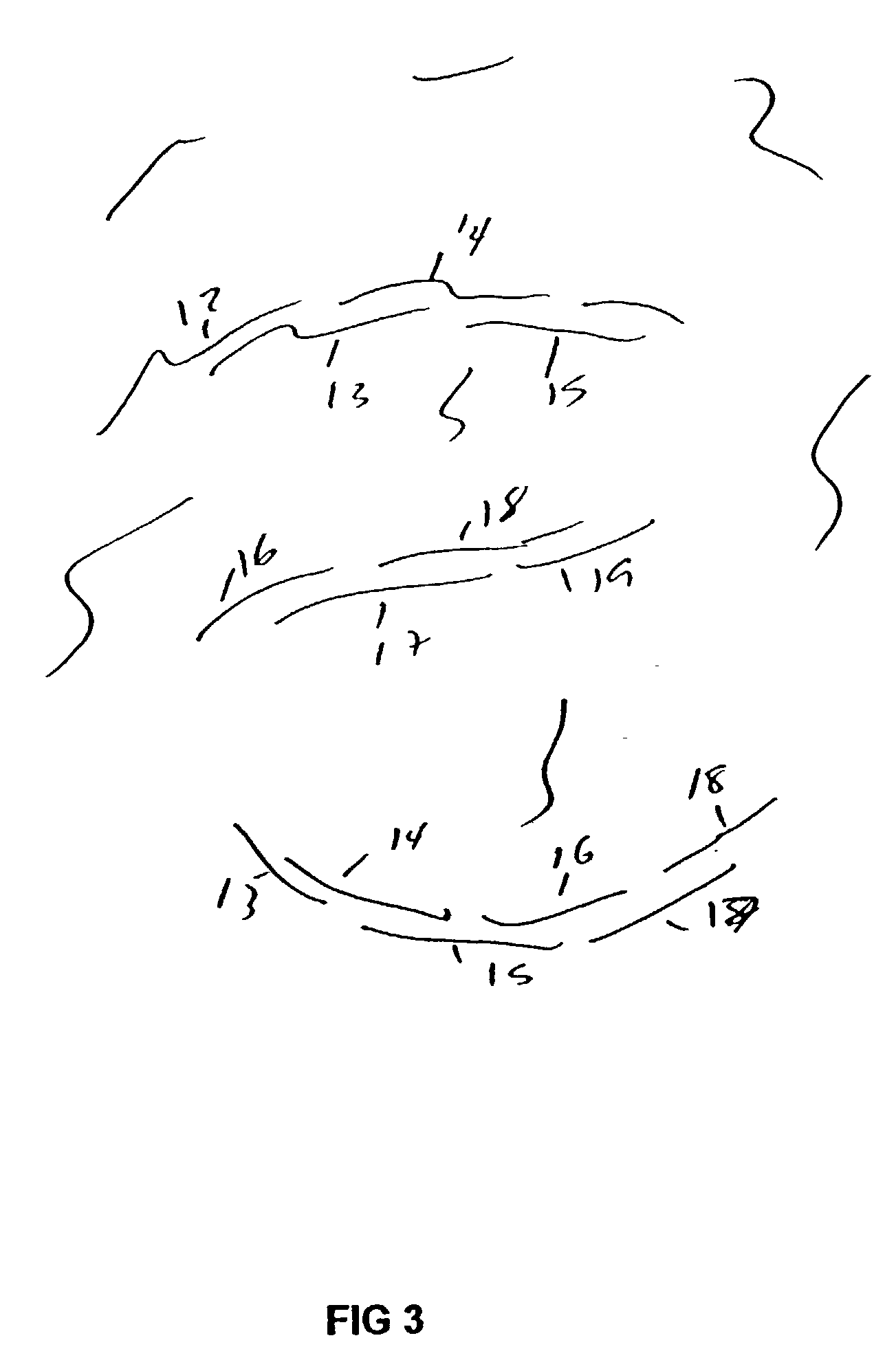 Method for the synthesis of DNA sequences