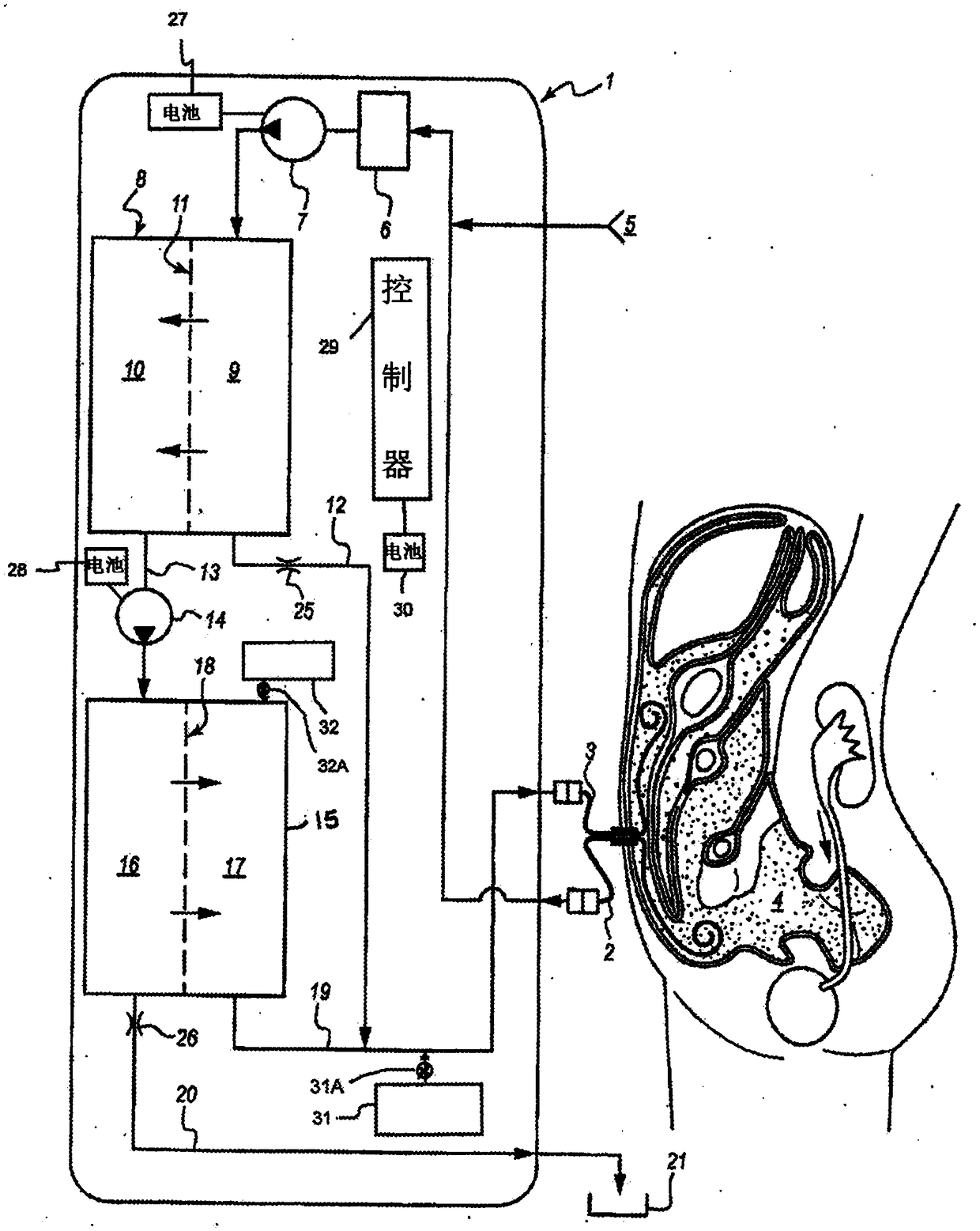 Peritoneal dialysis systems and methods