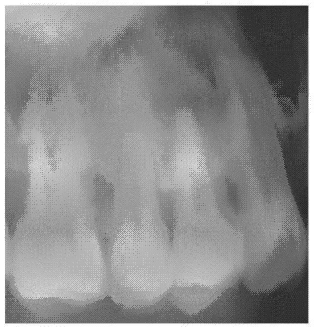 A tooth x-ray image matching method