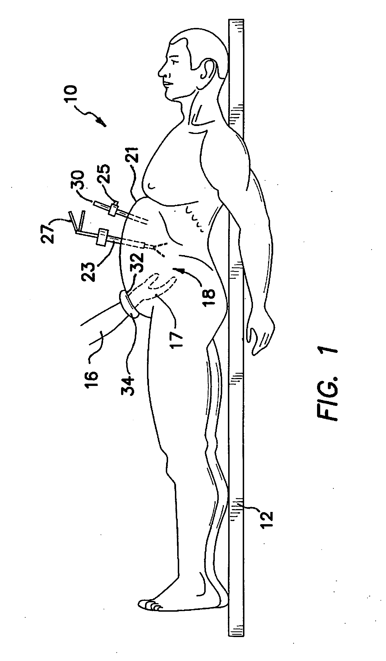 Surgical access system