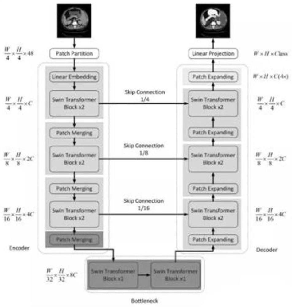 Gastric adenocarcinoma focus segmentation method based on Swinin-Unet