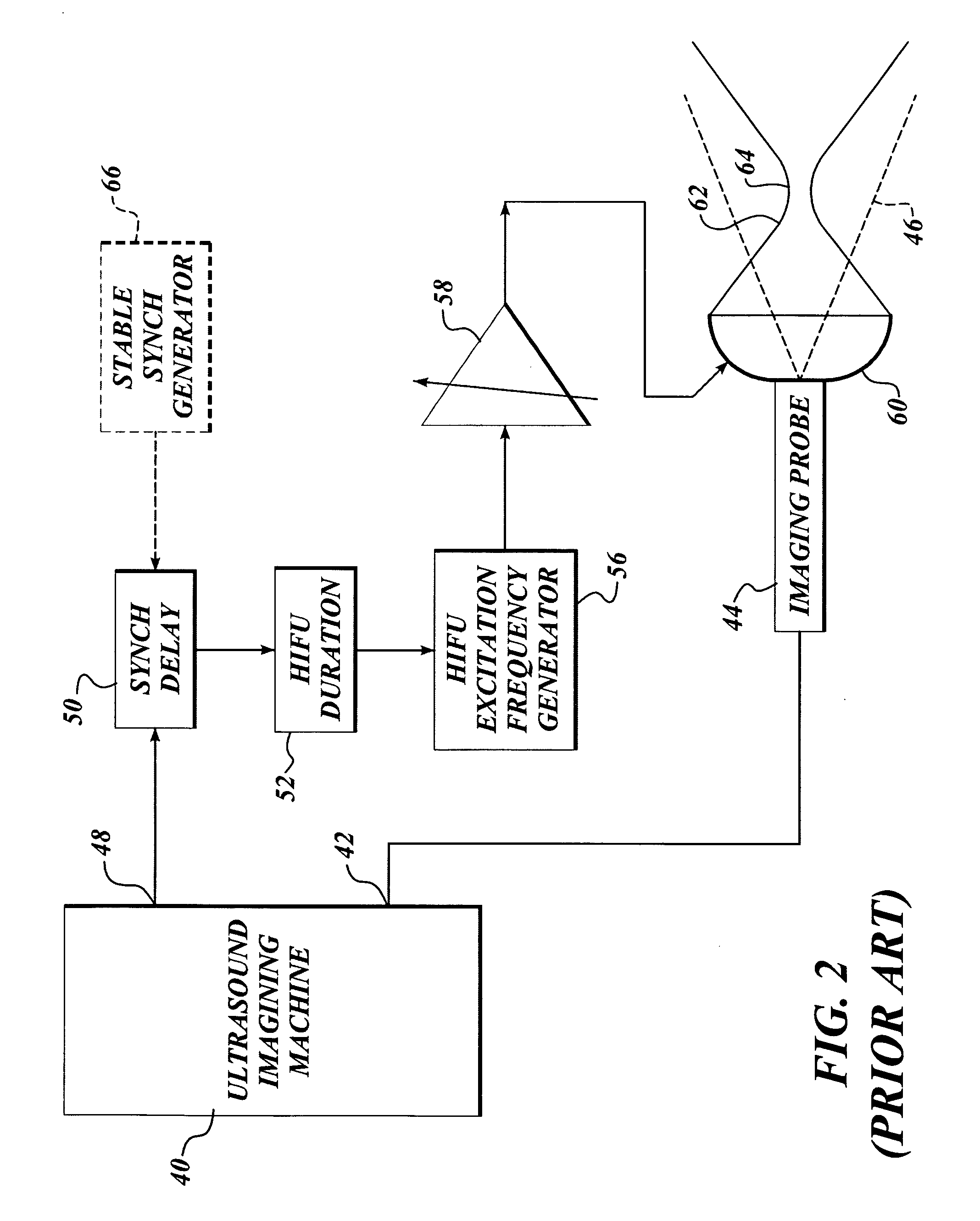 Method and system to synchronize acoustic therapy with ultrasound imaging