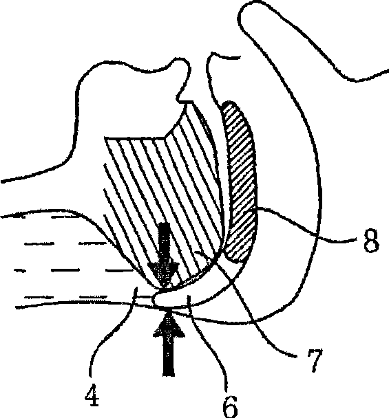 Apparatus for preventing sleeping respiratory disorder