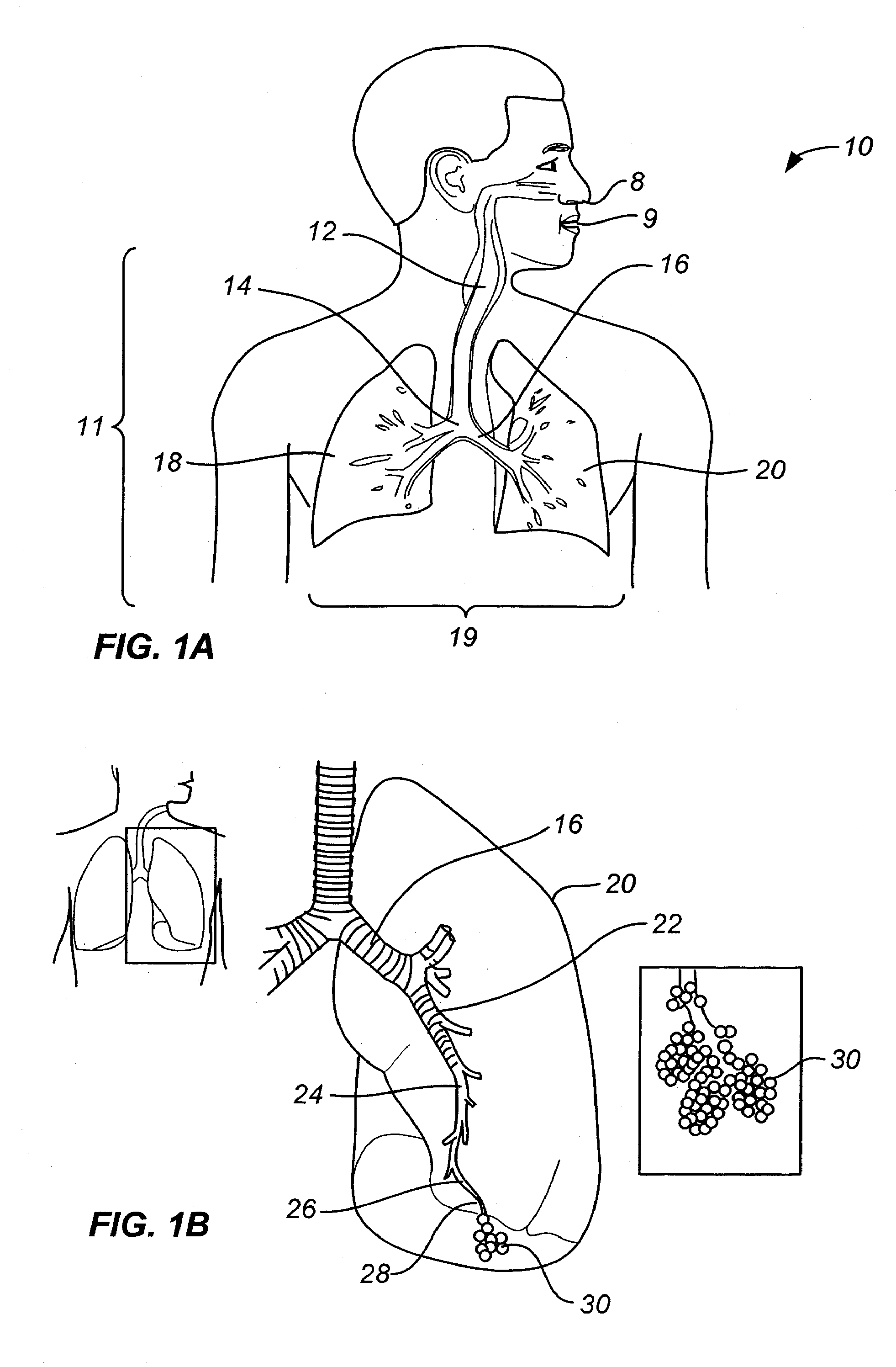 Minimally invasive lung volume reduction device and method