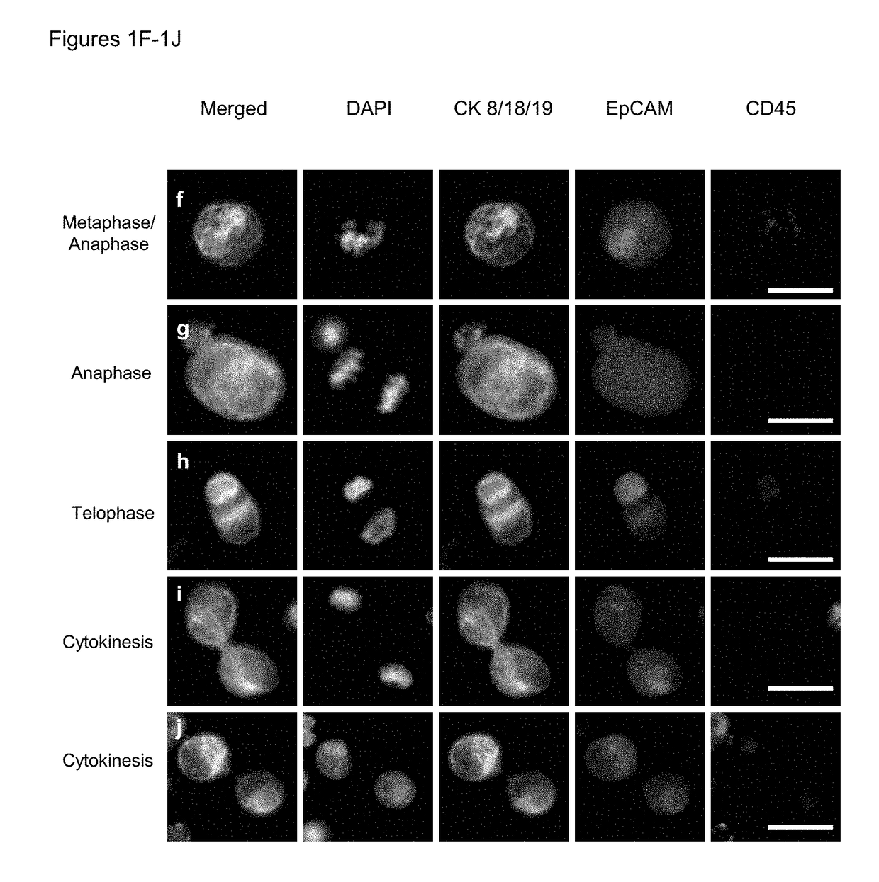 Use of circulating tumor cell mitotic index in cancer stratification and diagnostics