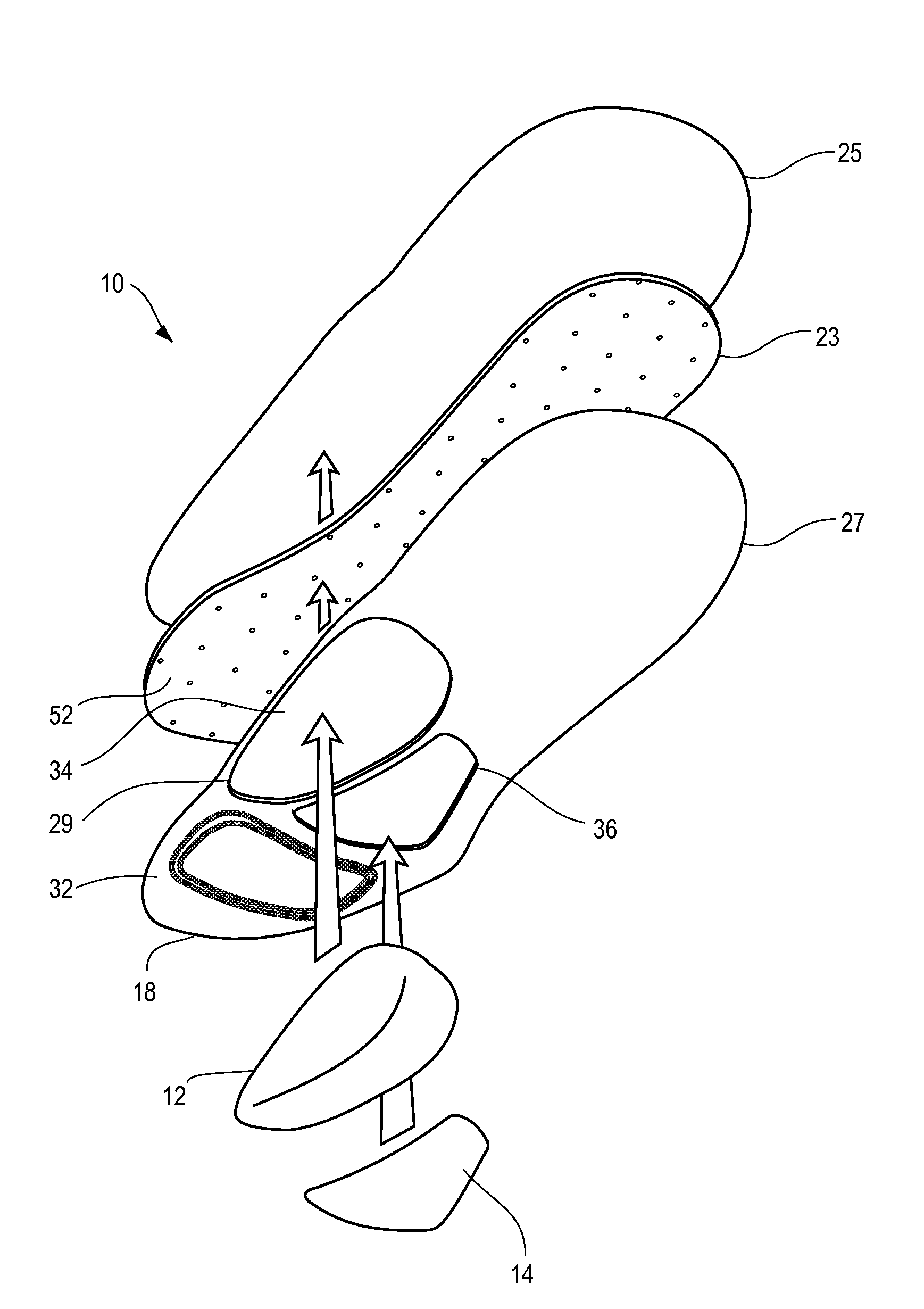 Orthotic foot device with removable support components and method of making same