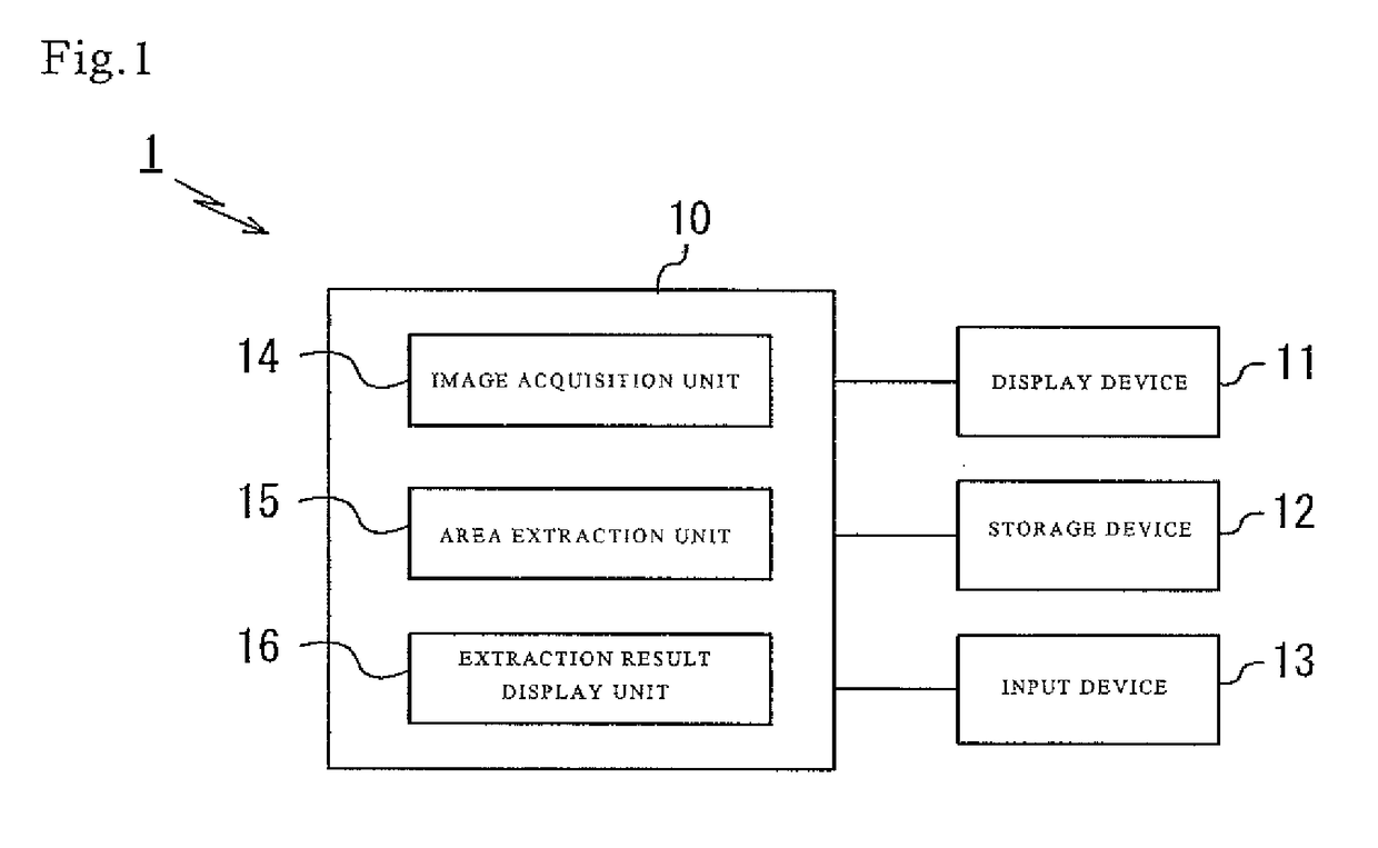 Method for displaying by determined color result image of area extraction result