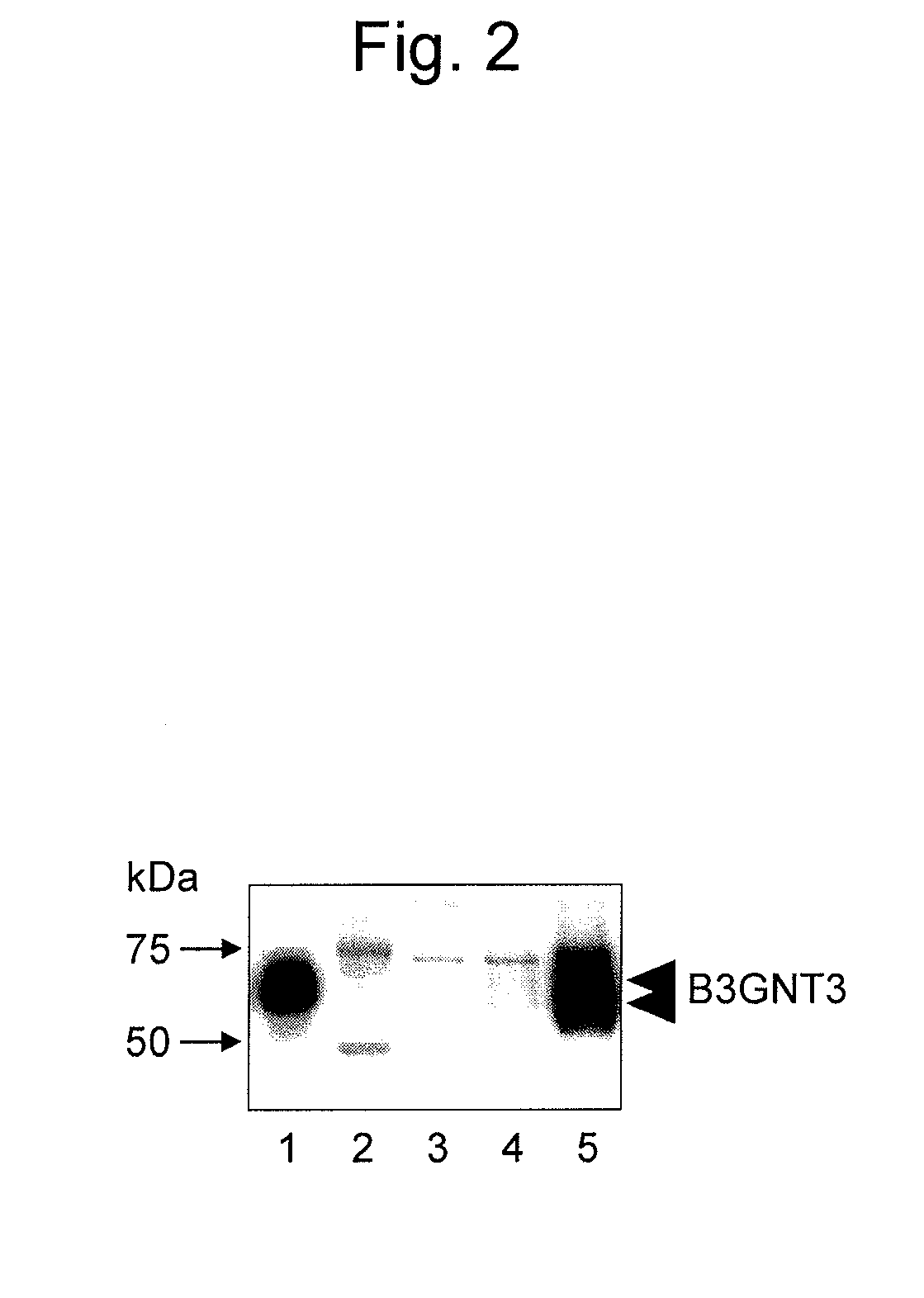 Antibody for detecting epithelial ovarian cancer marker and method for diagnosing epithelial ovarian cancer