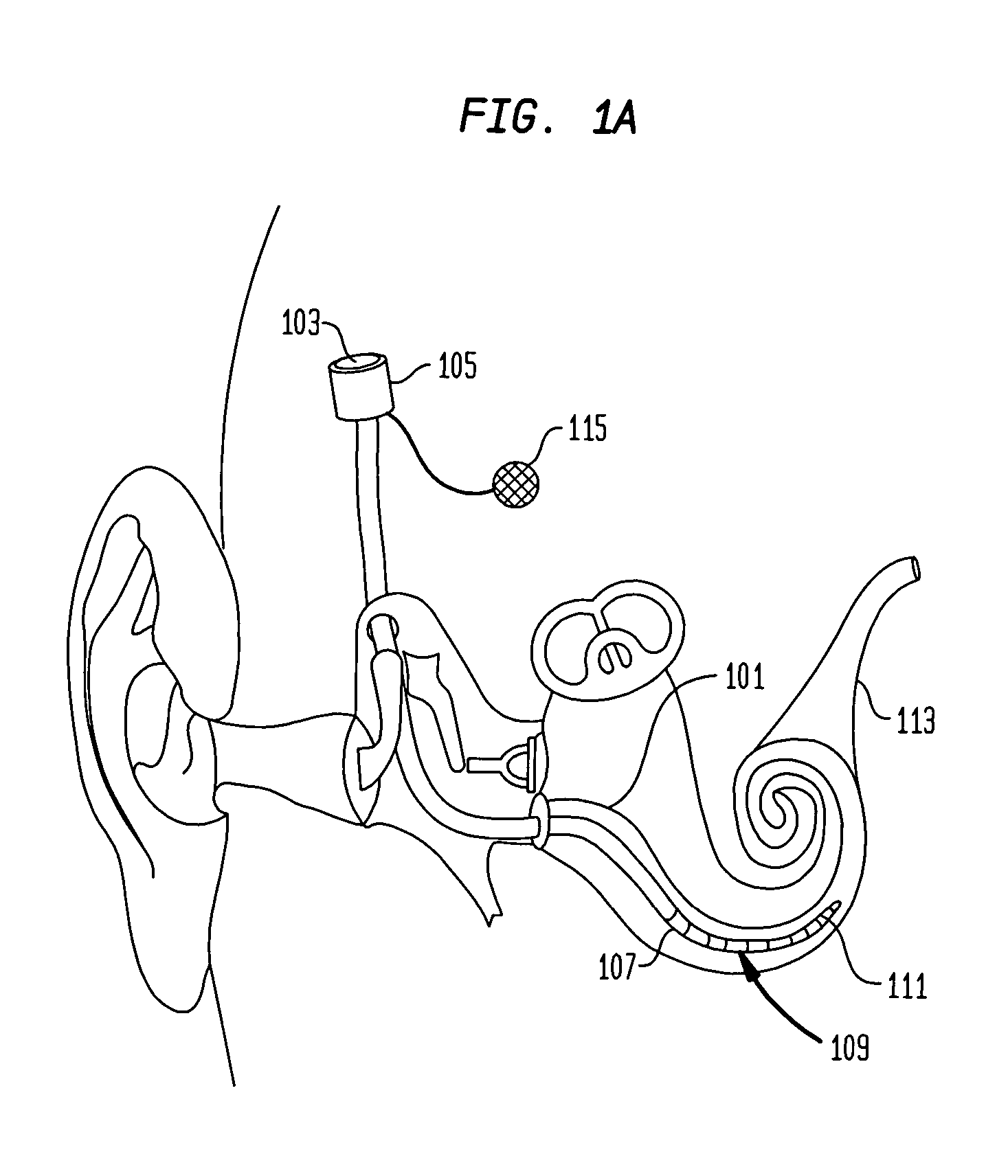 Multirate cochlear stimulation strategy and apparatus