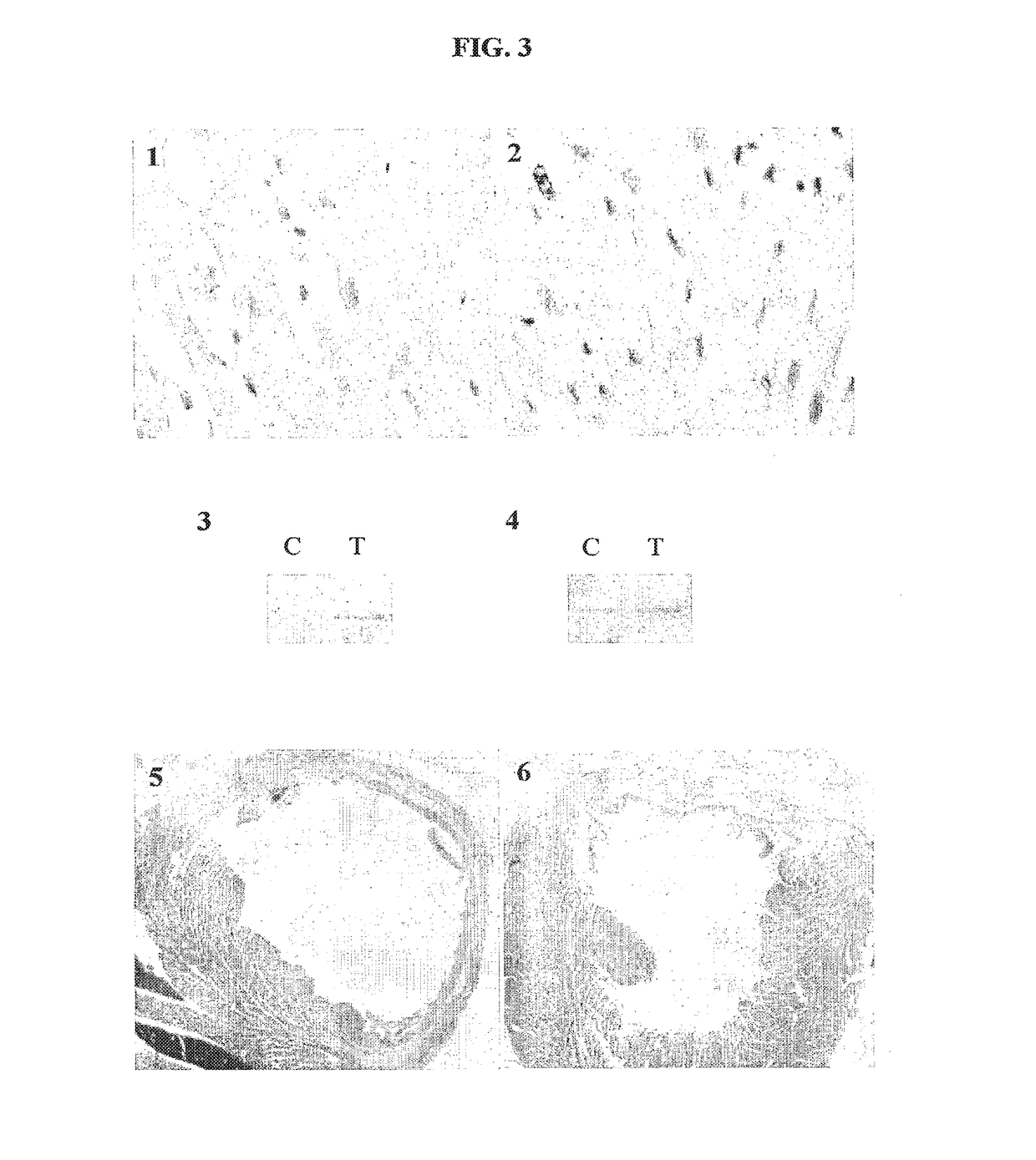 Pharmaceutical Composition and Method for Neoangiogenesis/Revascularization Useful in Treating Ischemic Heart Disease
