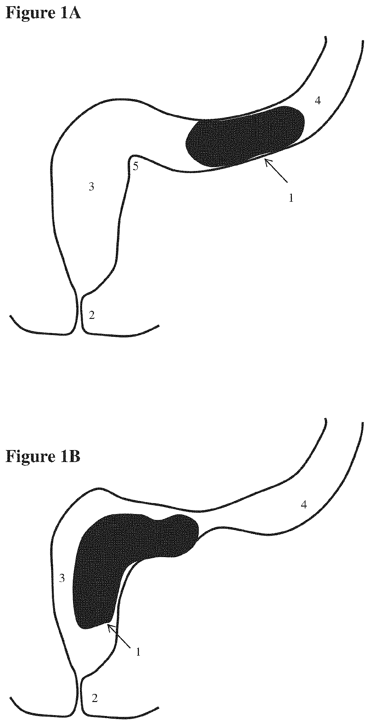 Devices for testing distal colonic and anorectal function