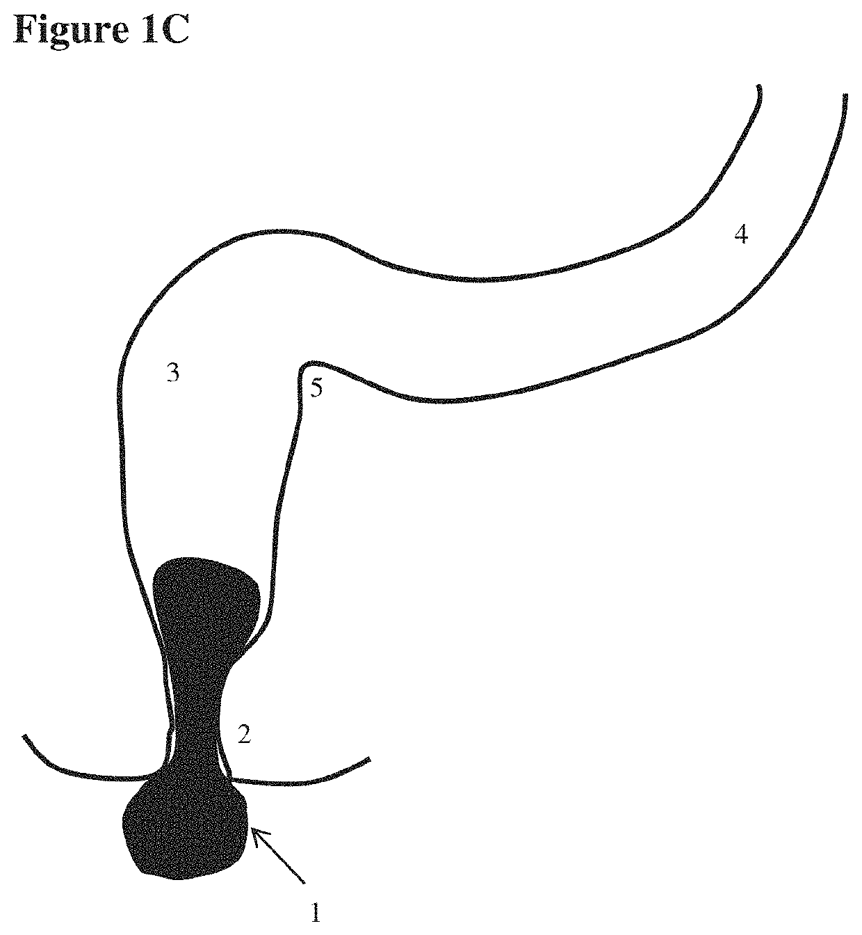 Devices for testing distal colonic and anorectal function