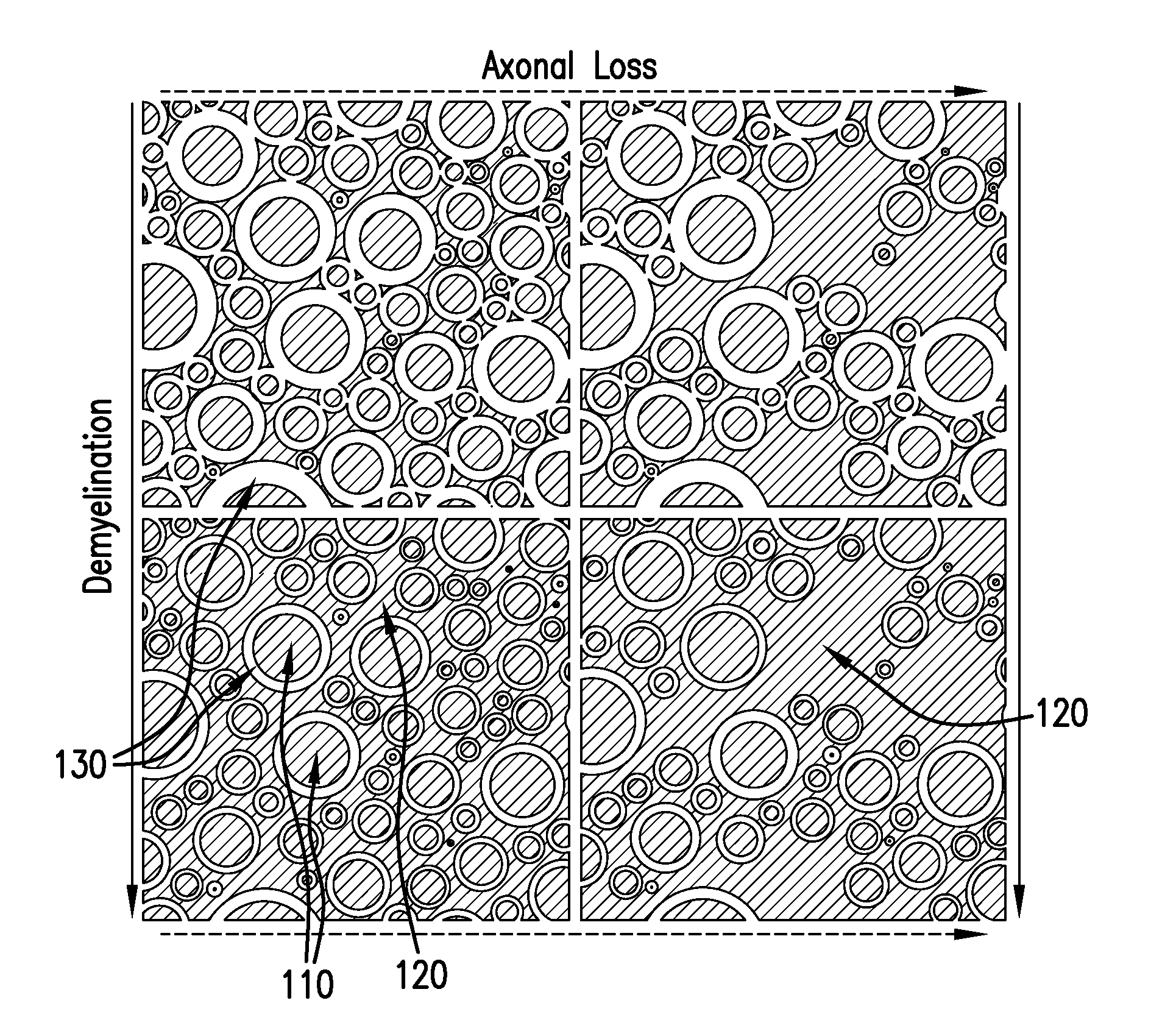 System, method and computer accessible mediums or determining neurodegeneration