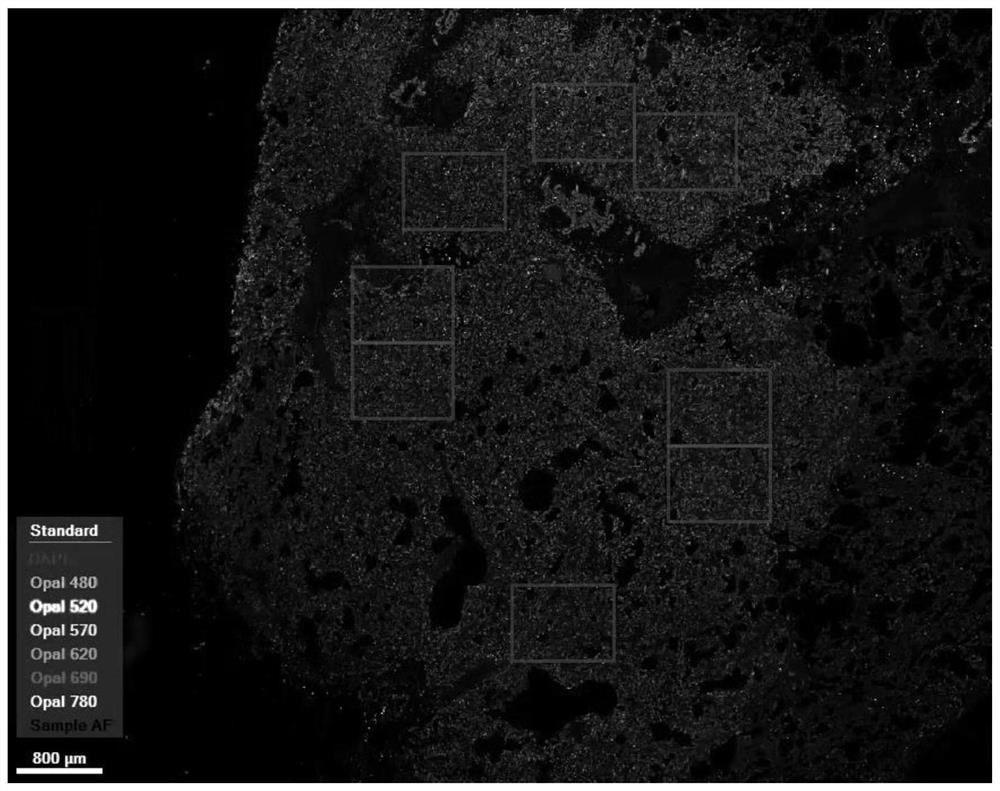 Tumor infiltrating lymphocyte analysis method and device and storage medium