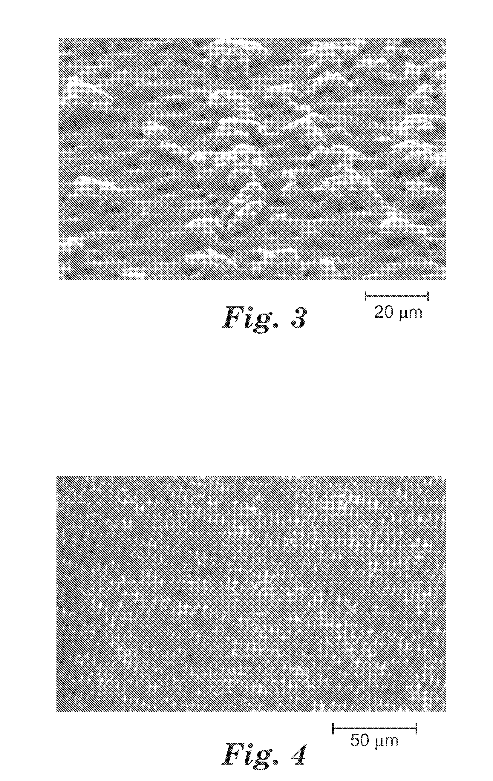 Remineralizing compositions and methods