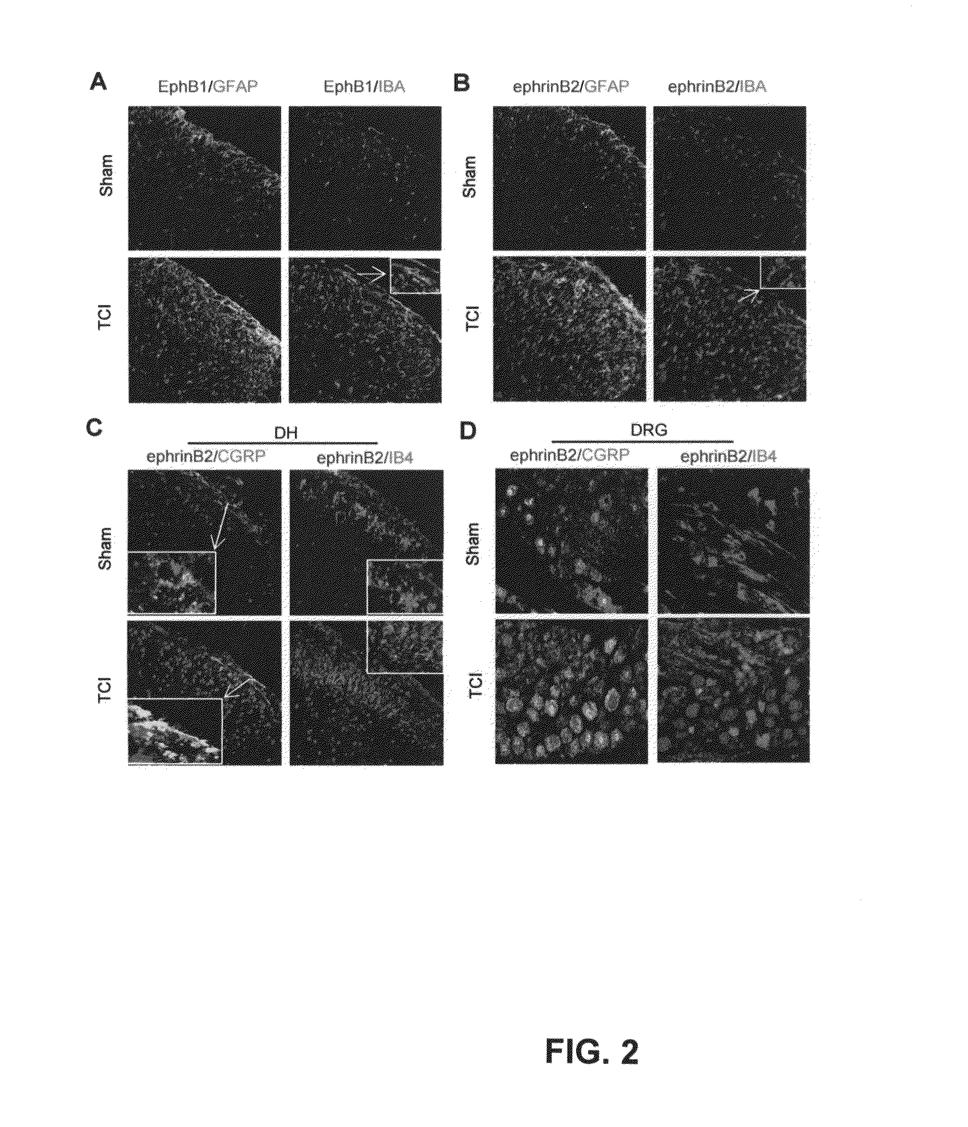 Method for treating cancer pain and/or rescuing analgesic effect of morphine treatment of cancer pain