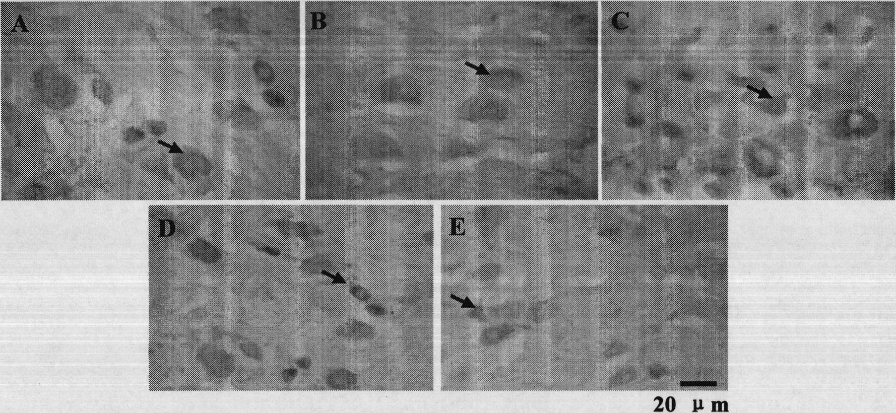 Application of puerarin to preparing medicine for treating P2X3 receptor mediated nerve system disease