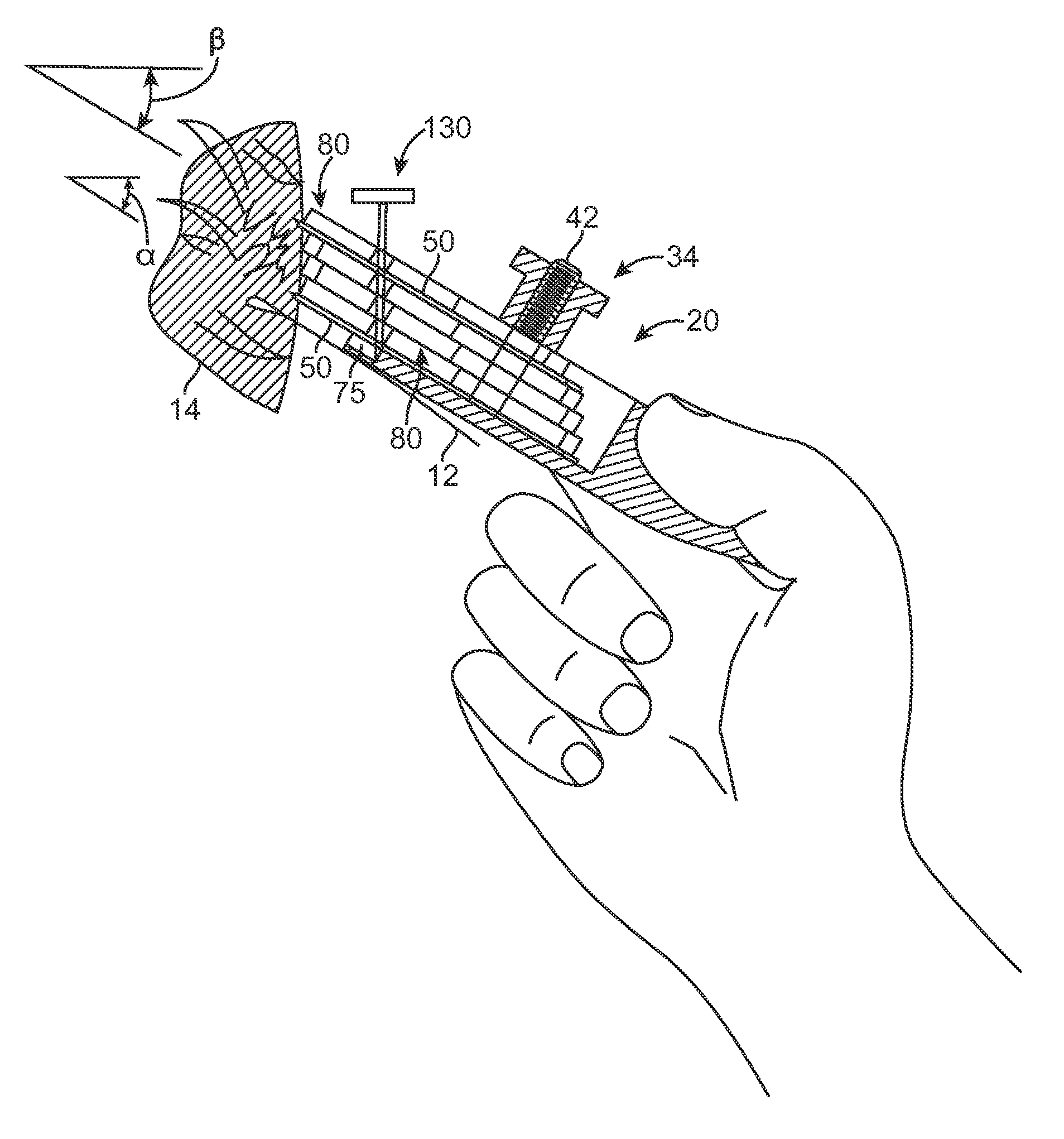 Multiple bladed surgical knife and method of use