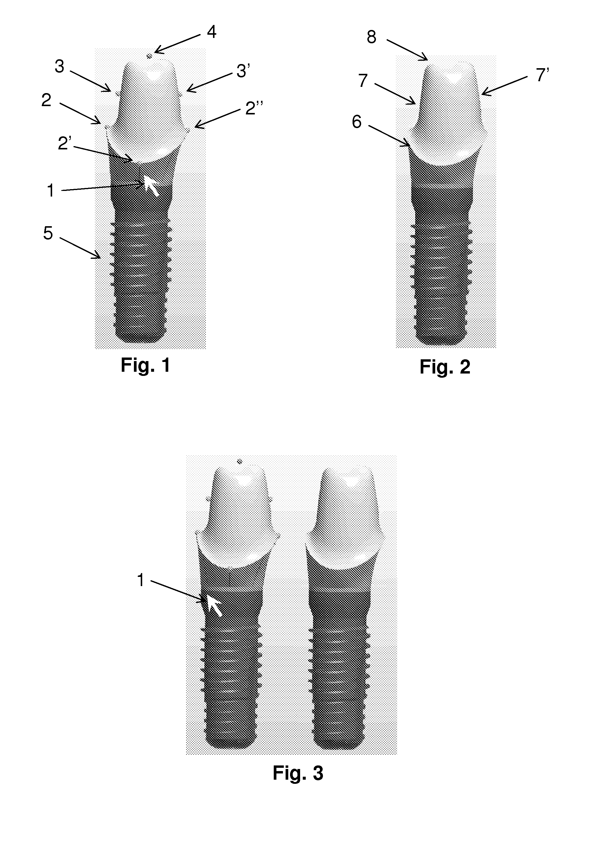 Tools for customized design of dental restorations