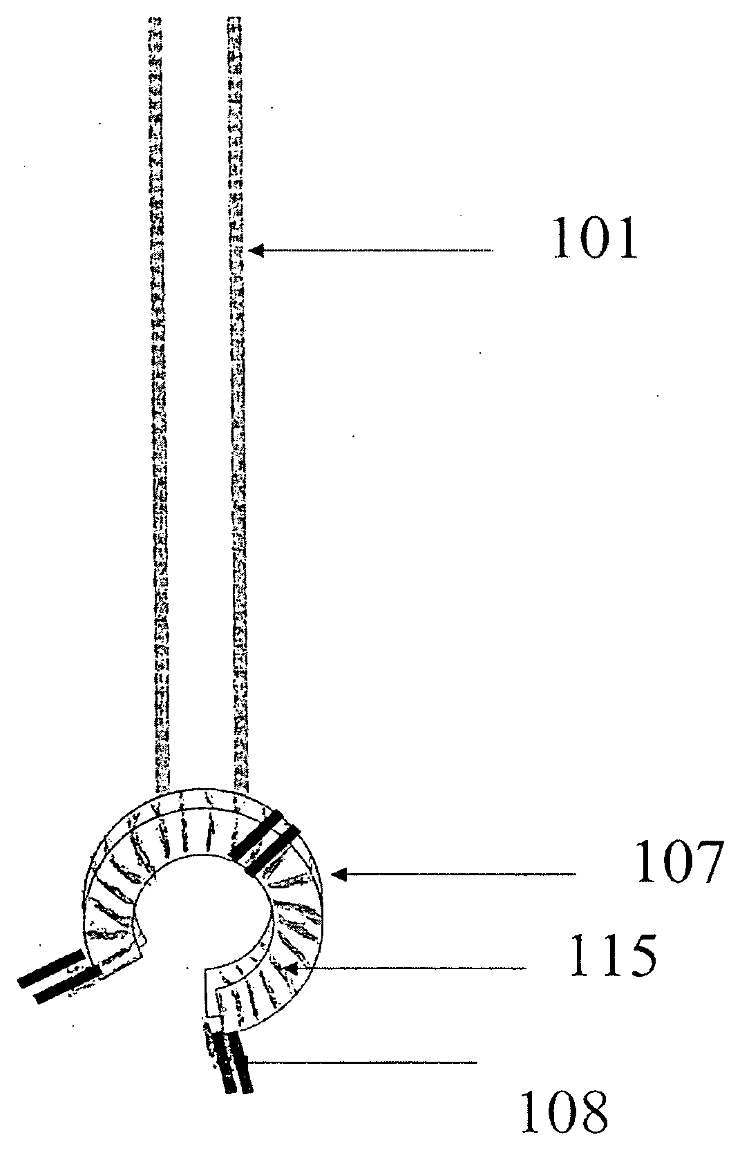 Suturing Device for Anastomisis of Lumens