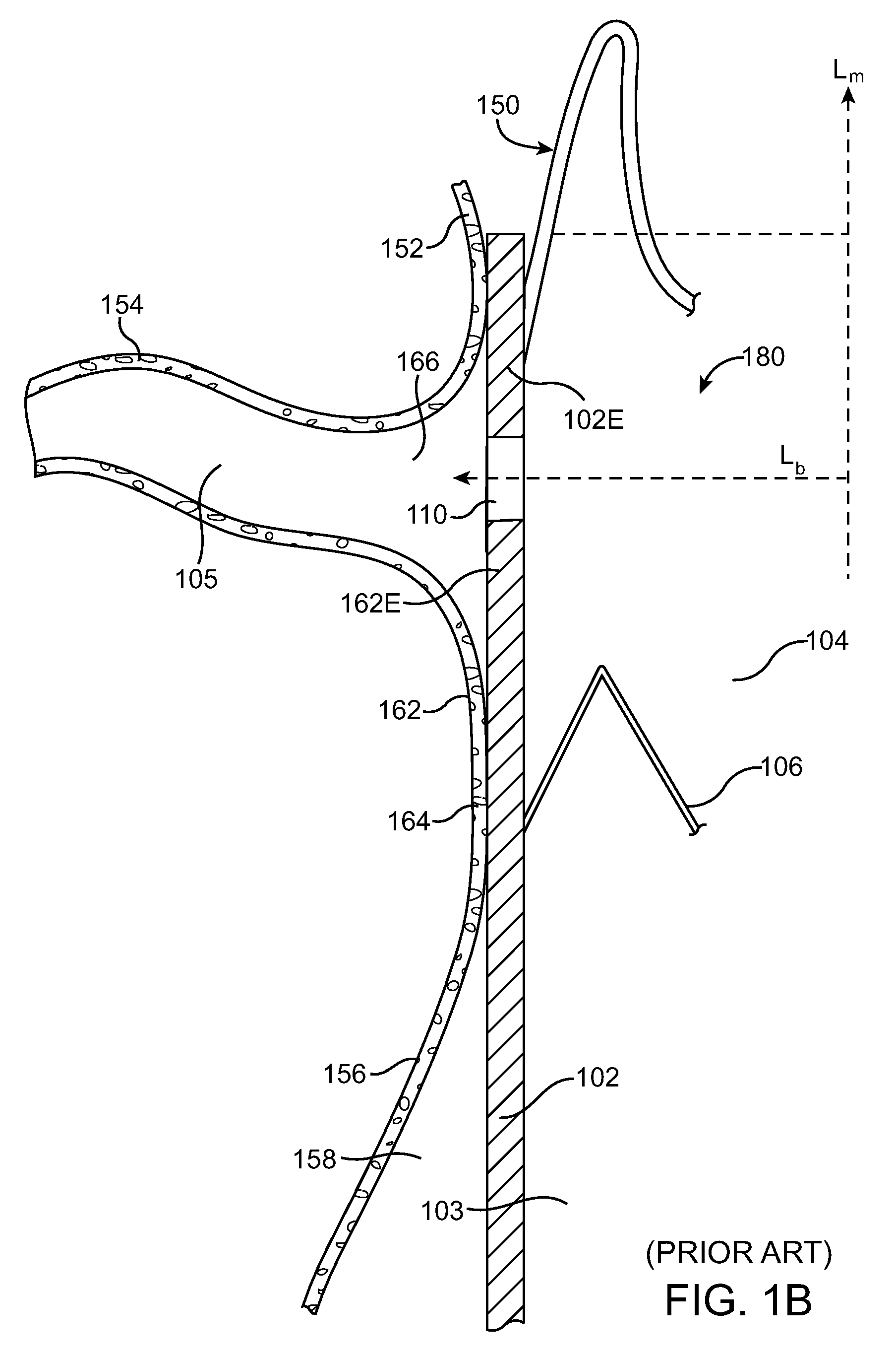 Stent graft having a flexible, articulable, and axially compressible branch graft