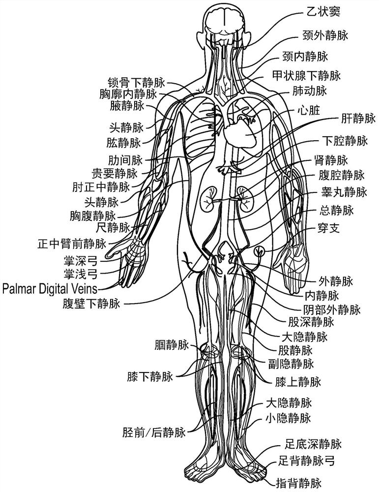 Intraluminal ultrasound navigation guidance and associated devices, systems, and methods